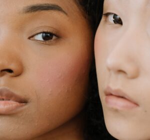 - Kosmetolog Koszalin I Anna Jurgielaniec