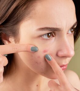 Kosmetolog Anna Jurgielaniec Koszalin