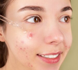 - Kosmetolog Koszalin I Anna Jurgielaniec