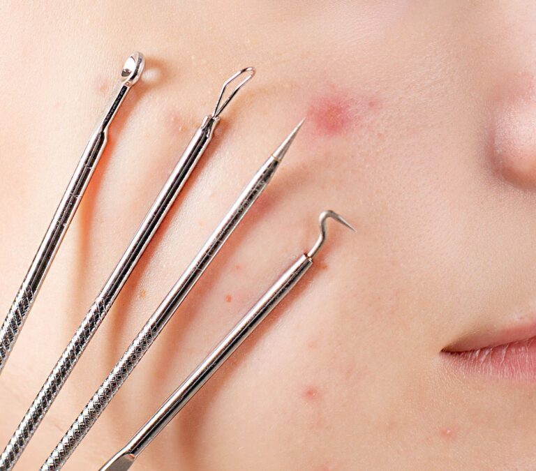 Łyżeczka do usuwania wągrów