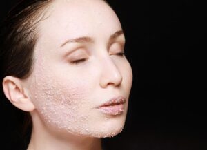 Jak złuszczać naskórek? Kilka wskazówek