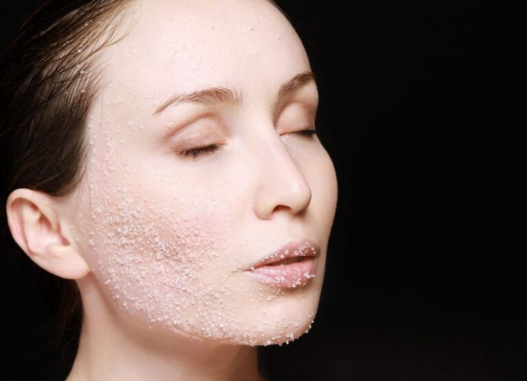 Dziewczyna, której jest potrzebne złuszczanie naskórka