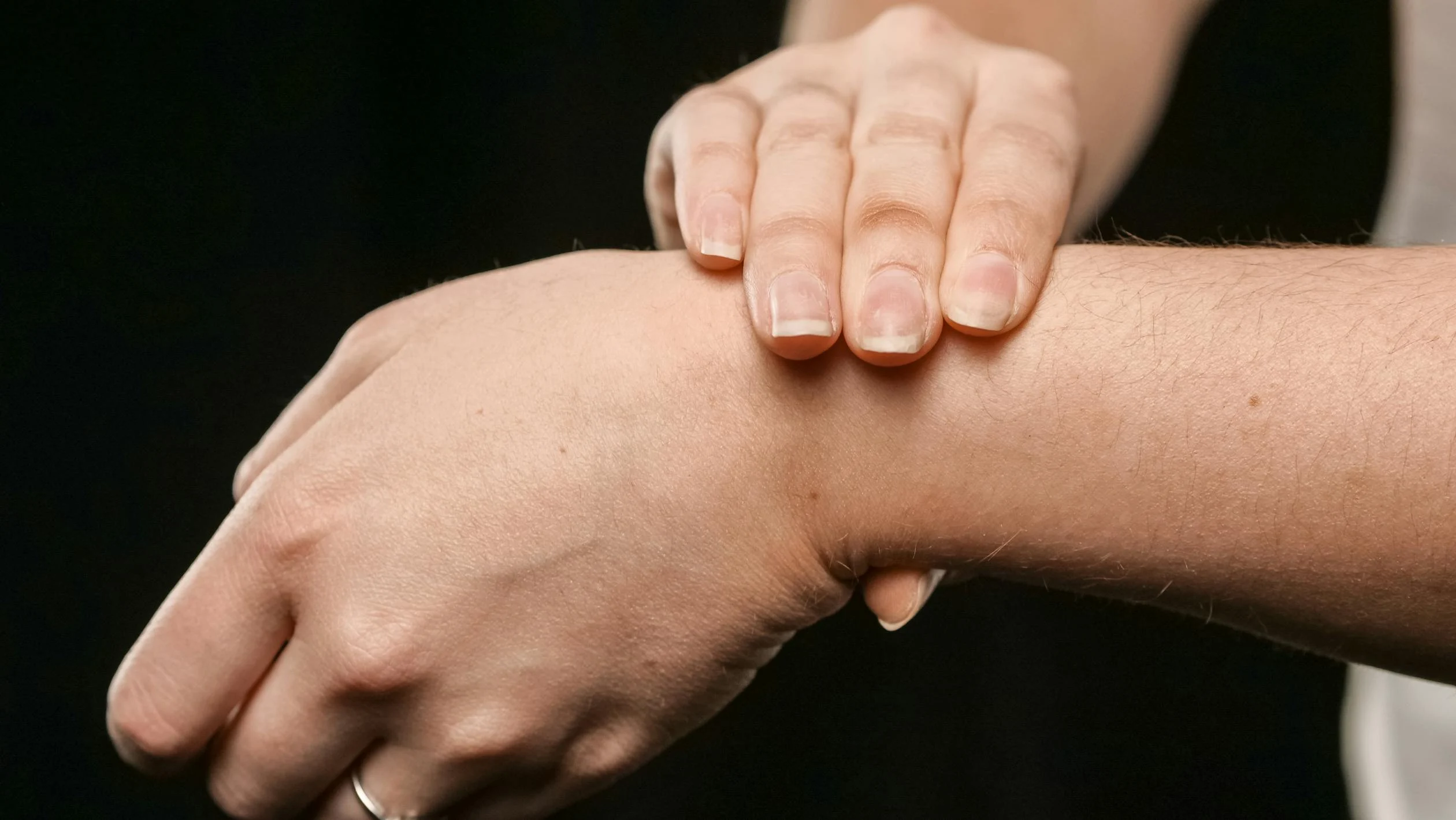 Dermatillomania